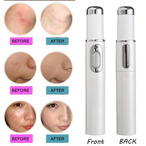 Blue Heal Pro - Acne Healing Pen